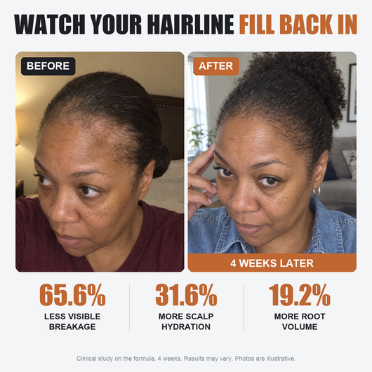 Pryme | Deoxyribose Scalp Serum