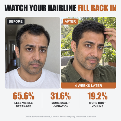 Pryme - Deoxyribose Scalp Serum